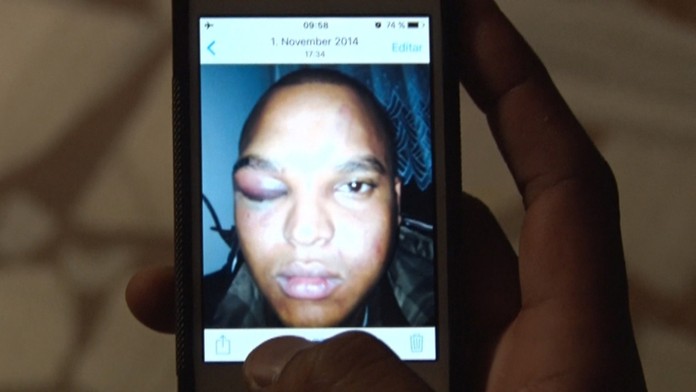 Fotografie zbitého Lennyho Cruza po útoku 1. novembra 2014. 