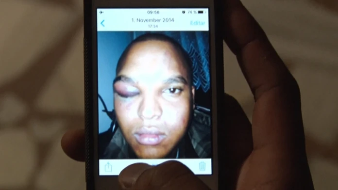 Fotografie zbitého Lennyho Cruza po útoku 1. novembra 2014. 