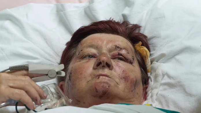 Zranená turistka Helena z okresu Trebišov zostáva hospitalizovaná v Centrálnej klinike v srbskom meste Niš.