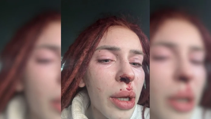 Čo robiť, ak ste obeťou domáceho násilia? Advokát radí zavolať skôr na linku dôvery ako ísť na políciu