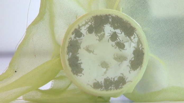 Encefalitída 