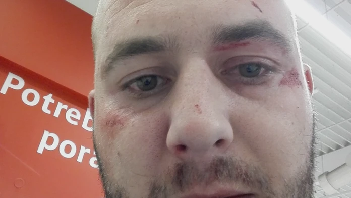 Mladého muža zbili pred obchodným domom pre nedorozumenie