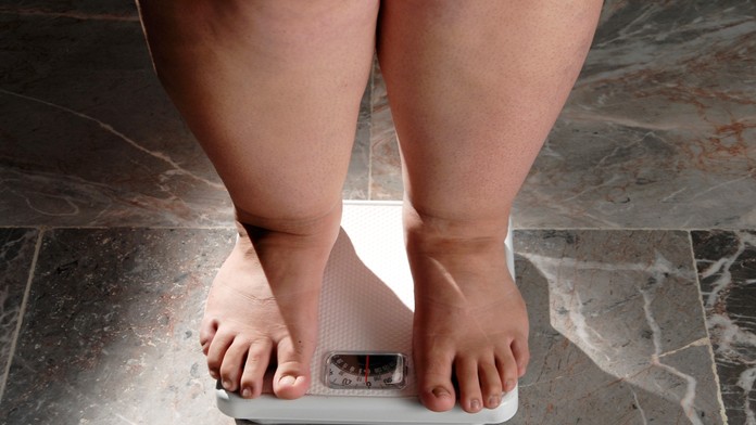 Zistenie, z ktorého budú mnohí prekvapení. Vedci našli hlavného vinníka obezity