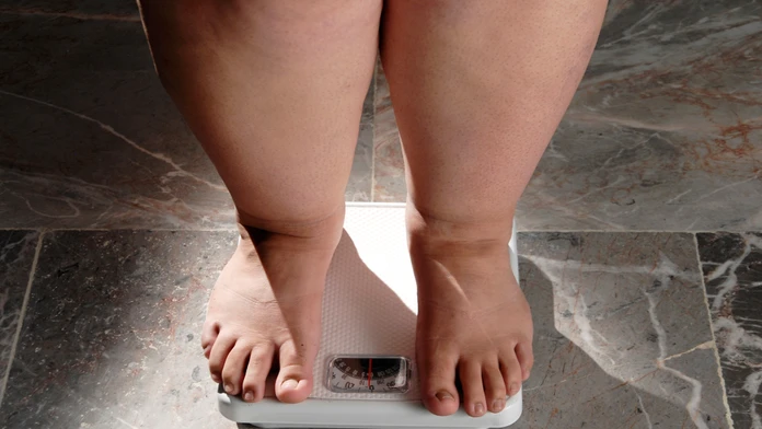 Zistenie, z ktorého budú mnohí prekvapení. Vedci našli hlavného vinníka obezity