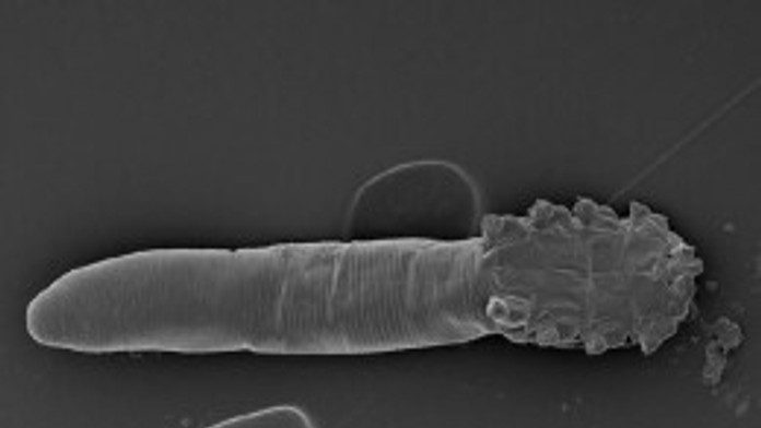 n-FACE-ARACHNIDS-large.jpg