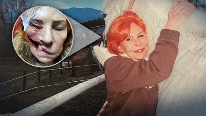 Parazit požiera Oľge tkanivo.