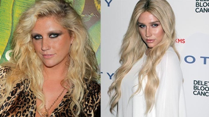 kesha.jpg