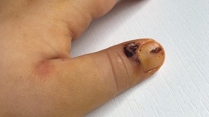 Ilustračná snímka.