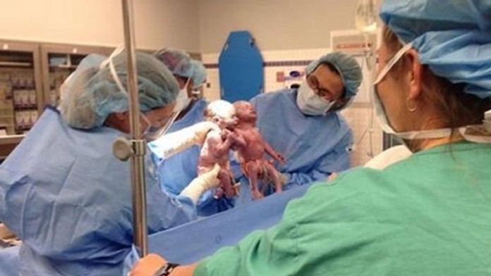 Dvojičky sa pri narodení držali za ruku