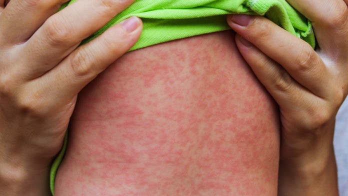 Ilustračná snímka.