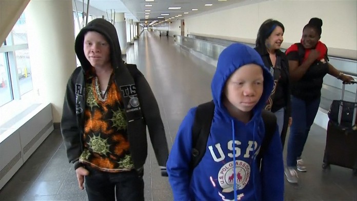 Deti zostanú dva mesiace v nemocnici Shriners vo Philadelphii, kde sa o nich postarajú lekári. 