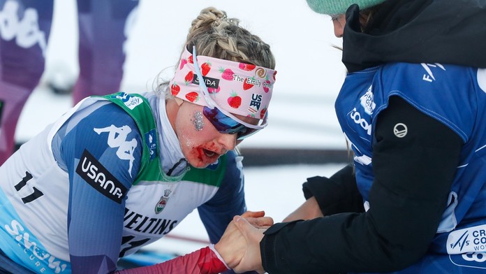 Jessie Diggins