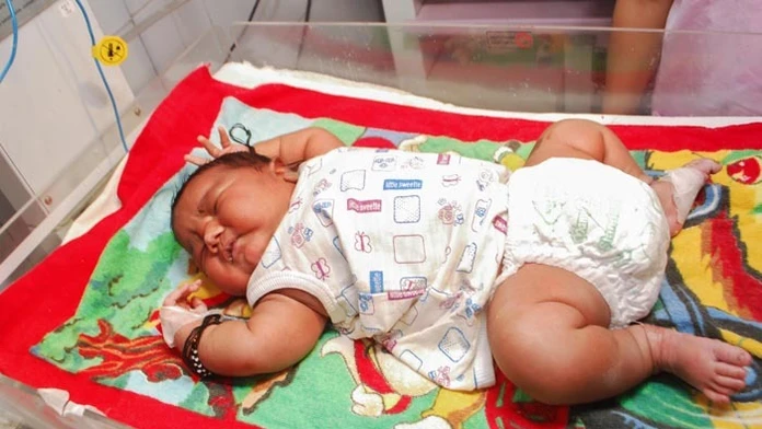 V Indii sa narodil chlapček, ktorý vážil 6 kilogramov. 