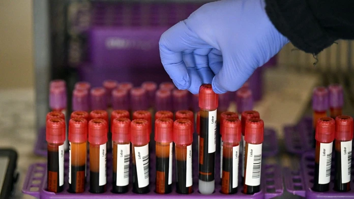 Experiment odhalil, prečo sa niektorí ľudia infikujú koronavírusom a iní nie