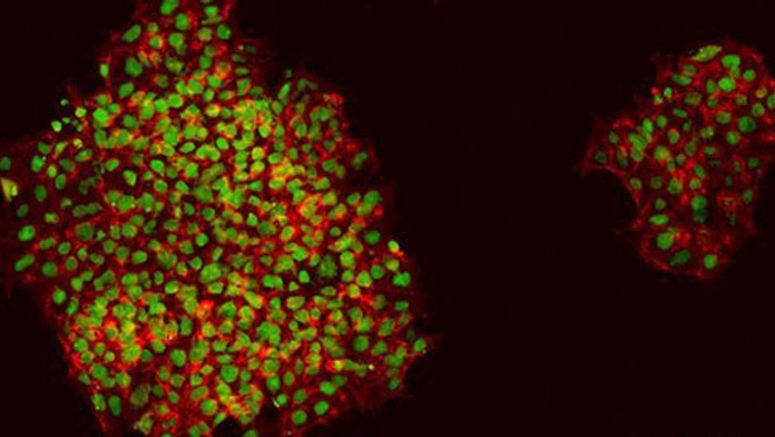 _74404000_ipsc-derivedkeratinocytescolonies-3.jpg