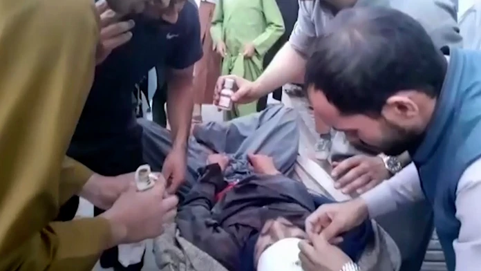 Zranený muž neďaleko miesta výbuchu pri letisku v Kábule.