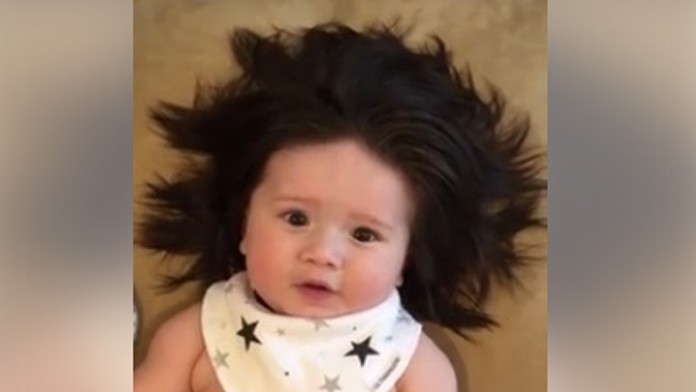 Nie, nemá parochňu. Takéto vlasaté dieťa ste ešte nevideli