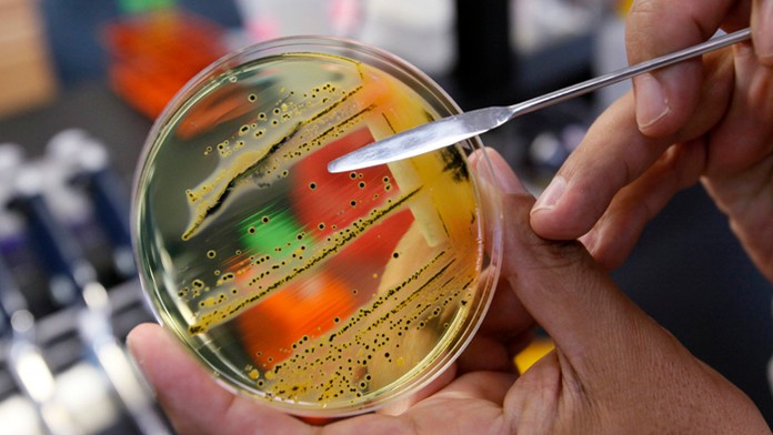 Na archívnej snímke zo 17. mája 2010 rast baktérie salmonely na Petriho miske.