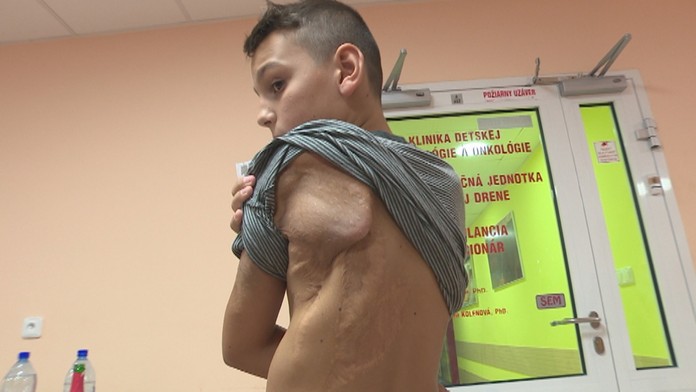 Lukáš si prežil viac bolesti ako ktorýkoľvek dospelý