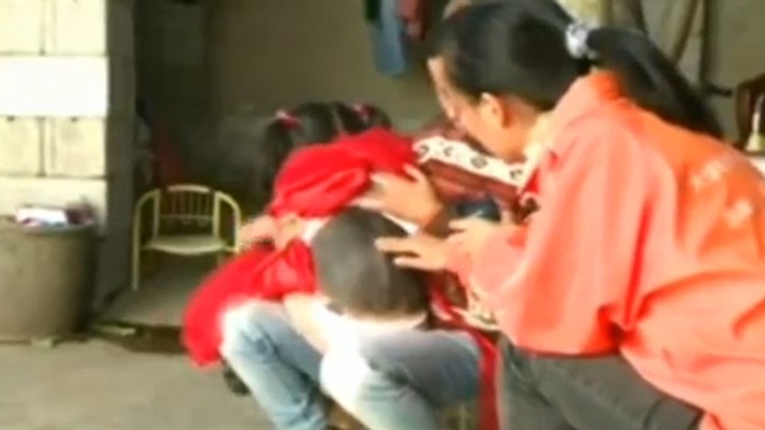 Dievčatko má chrbát pokrytý hustou srsťou