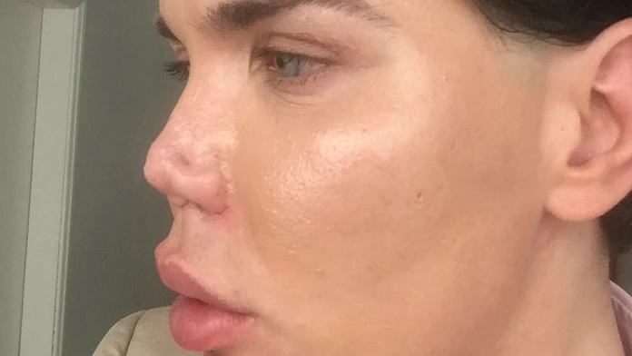 Rodrigo Alves 