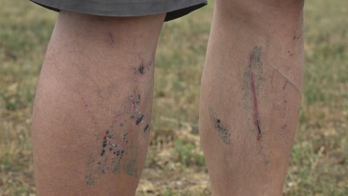 Stopy po medvedích zuboch