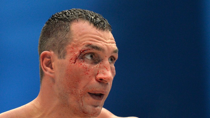 Netradičný pohľad na Vladimira Klička v ringu.