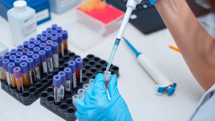 Vedci testujú vírus, ktorý má stopercentnú úmrtnosť. Priebeh ochorenia je desivý