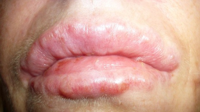 Lekári tvrdia, že takéto problémy bude mať ešte veľa pacientok