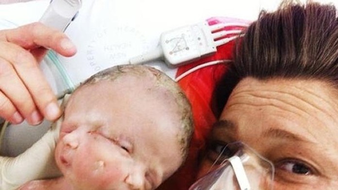 V Sydney sa narodili vzácne dvojičky