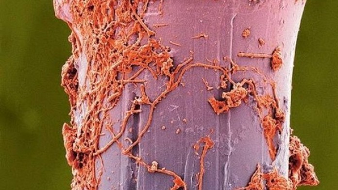 Štetina zo zubnej kefky