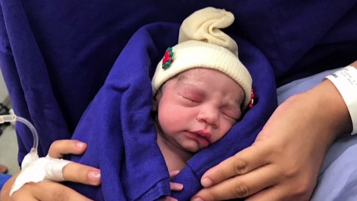 Bábätko sa narodilo z transplantovanej maternice