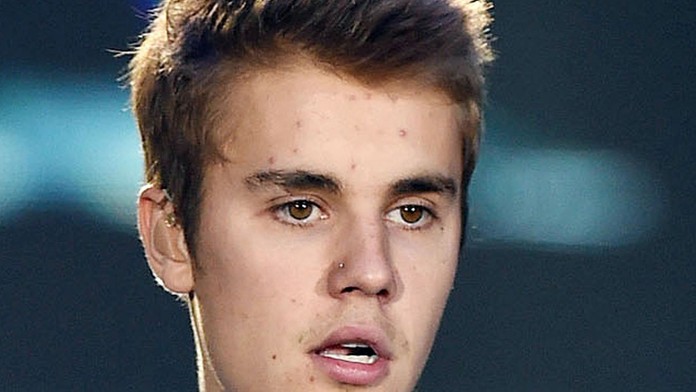 Bieber na koncertoch viac rozpráva ako spieva. Už viackrát ho vypískali