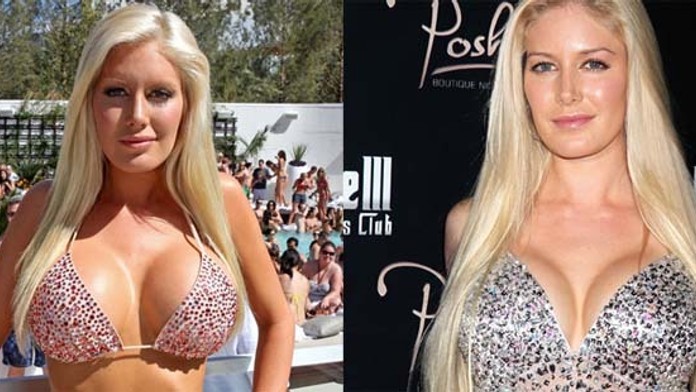 Heidi Montag