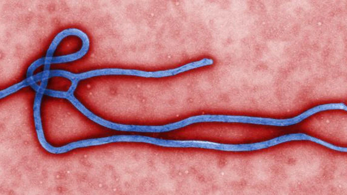 Vírus ebola