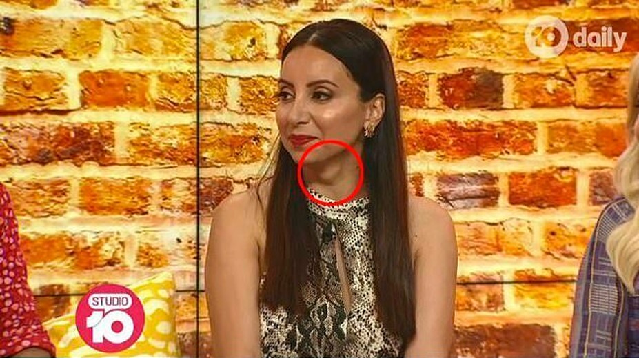 Pozorná diváčka zachránila redaktorke život. Všimla si problém a včas ju upozornila