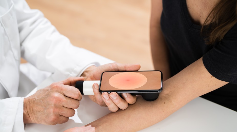 Rýchlejšia diagnostika rakoviny kože vďaka novému objektívu. Pripojiť sa dá na smartphone