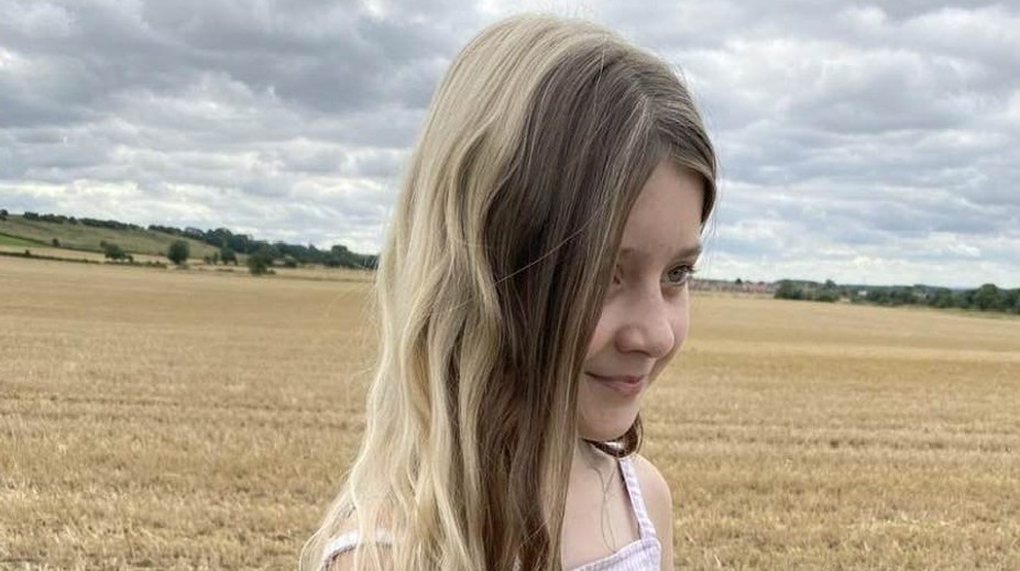 Bella (11) má od narodenia dve farby vlasov. Za všetko zrejme môže táto porucha