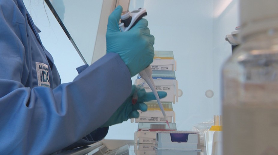 Nádejná správa vedcov. Vyvinuli bezbolestný spôsob, vďaka ktorému sami zistíte, či máte covid