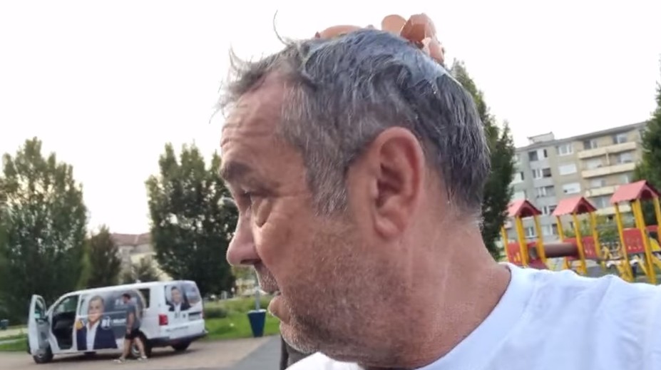 Dohra útoku vajcom na poslanca Pročka. Mesto prešetrí postup polície