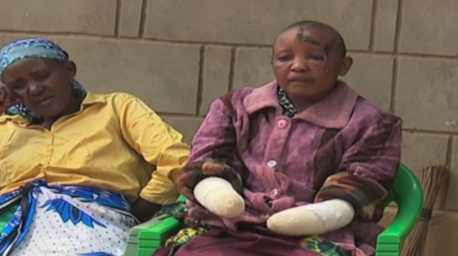 Impotentný muž odsekol svojej žene obe ruky, pretože nedokázala otehotnieť