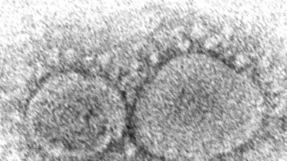 Biden podpísal zákon o odtajnení informácií o pôvode koronavírusu