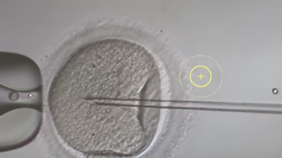 Dávajú nádej párom, ktoré majú problém počať dieťa. Ako vyzerá proces darovania vajíčok?