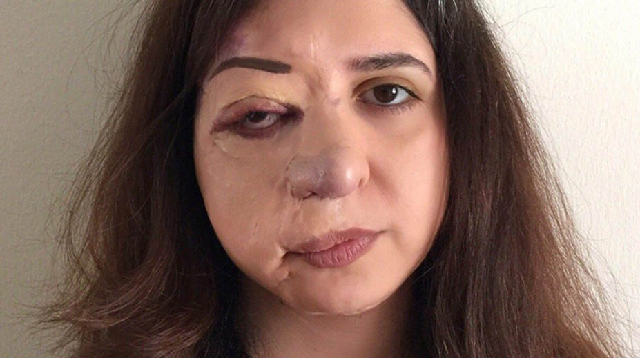 Roky si o nej mysleli, že má nákazlivú chorobu. Ľudia nechceli, aby vychádzala z domu