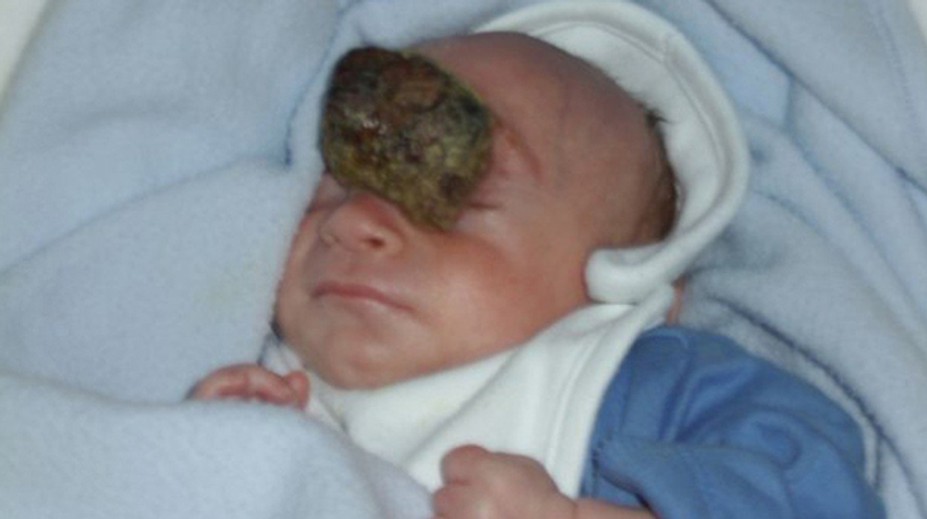 Jamie sa narodil s mozgom mimo lebky. Mal žiť len hodinu, on však oslávil 10. narodeniny