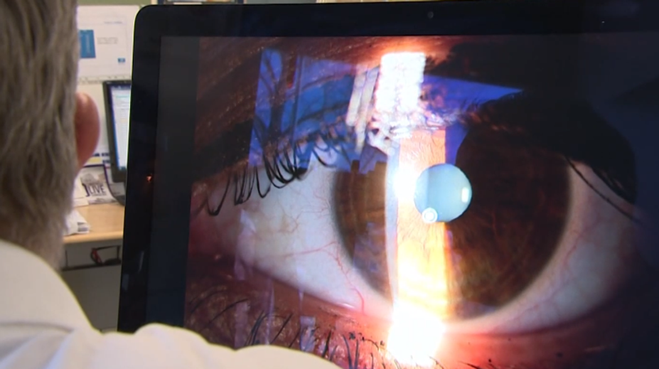 Lekárka, ktorá vyoperovala pacientovi nesprávne oko, spoznala trest