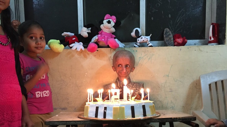 Všetkých prekvapil. Chlapec uväznený v tele starca oslávil 15. narodeniny