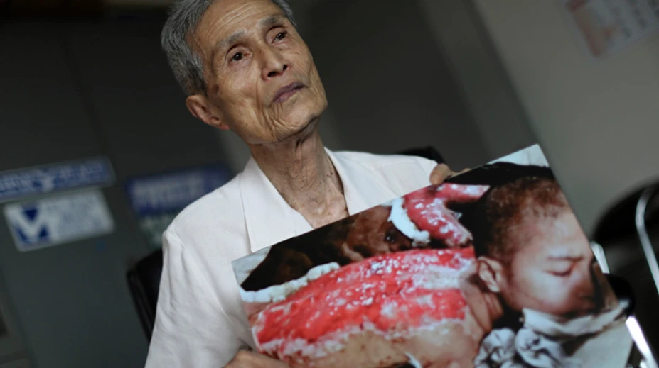Zomrel Sumiteru Taniguči, ktorý prežil útok atómovou bombou na Nagasaki