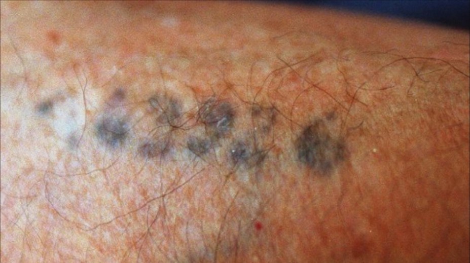 Väzňom tetoval čísla: Krutý príbeh žida z Krompách obletel svet