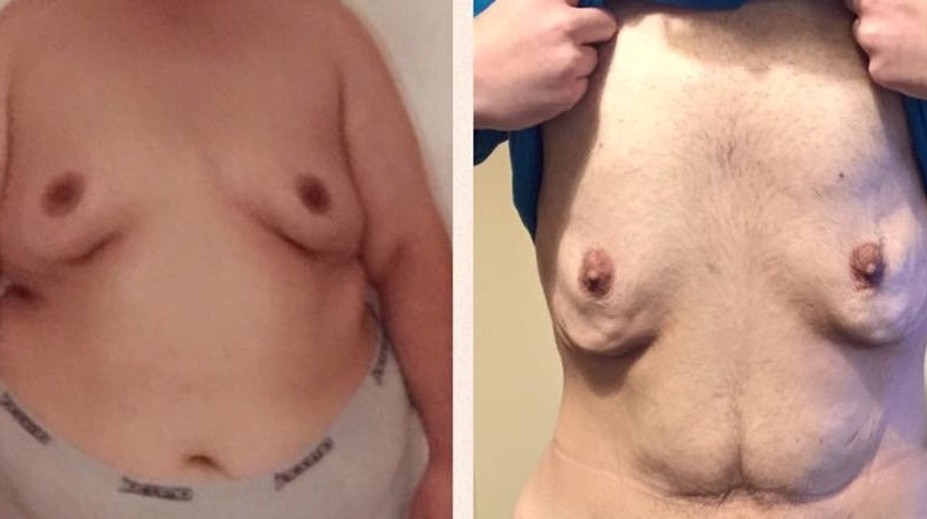 Neuveriteľná premena 200-kilového chlapa. Pozrite, ako vyzerá dnes